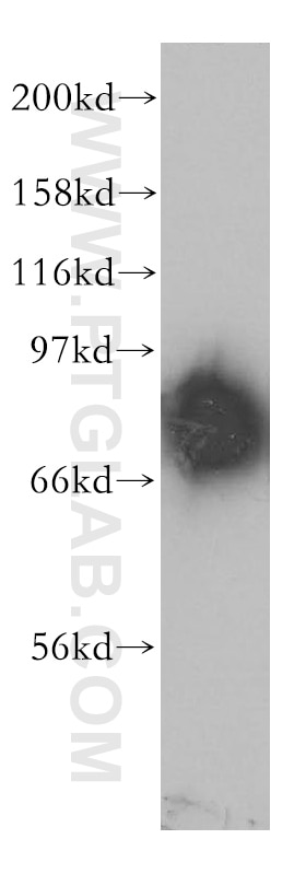 WB analysis of mouse brain using 12918-1-AP