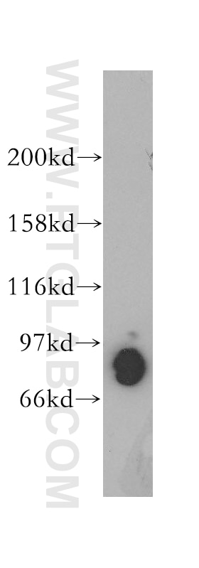 Western Blot (WB) analysis of mouse pancreas tissue using PDE4D Polyclonal antibody (12918-1-AP)