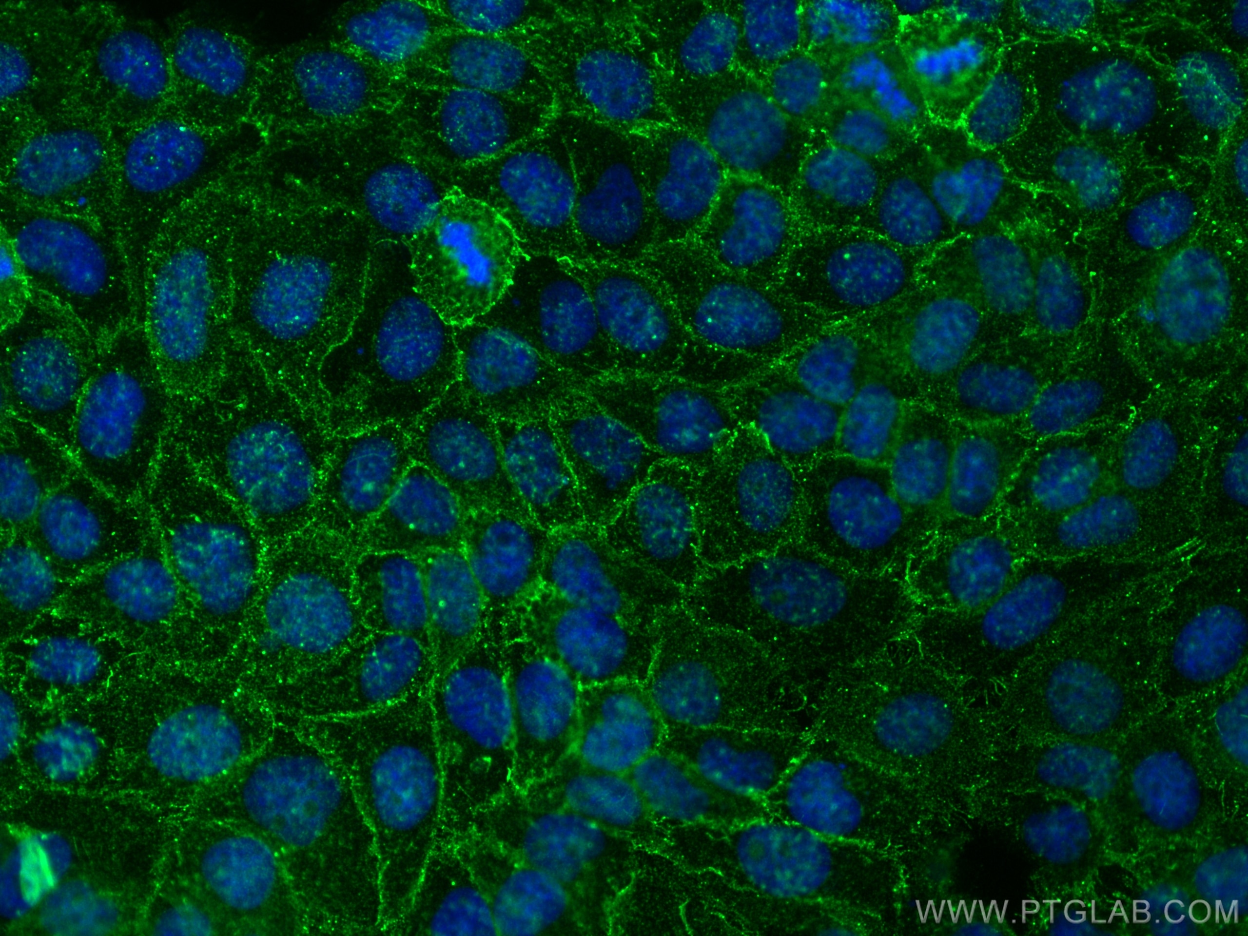 Immunofluorescence (IF) / fluorescent staining of A431 cells using PDE4D Monoclonal antibody (67062-1-Ig)