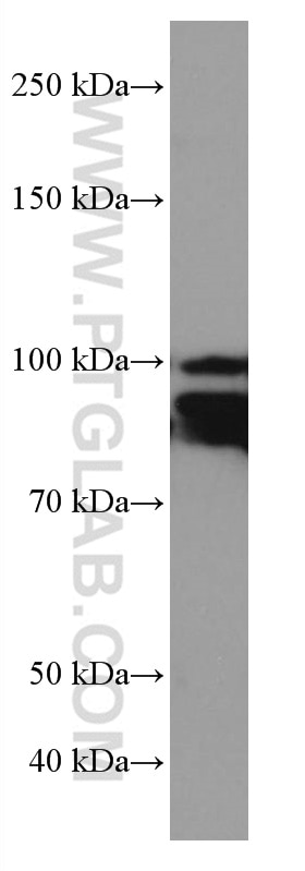 Western Blot (WB) analysis of pig cerebellum tissue using PDE4D Monoclonal antibody (67062-1-Ig)