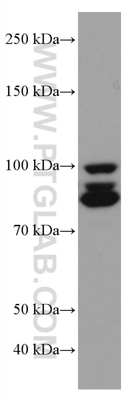 Western Blot (WB) analysis of rat brain tissue using PDE4D Monoclonal antibody (67062-1-Ig)