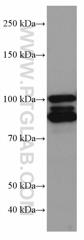 Western Blot (WB) analysis of mouse brain tissue using PDE4D Monoclonal antibody (67062-1-Ig)