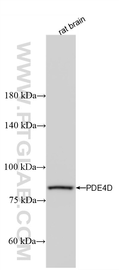 Rat brain tissue were subjected to SDS PAGE followed by western blot with 86745-1-RR (PDE4D antibody) at dilution of 1:10000 incubated at room temperature for 1.5 hours. Western Blot (WB) analysis of rat brain tissue using PDE4D Recombinant monoclonal antibody (86745-1-RR)
