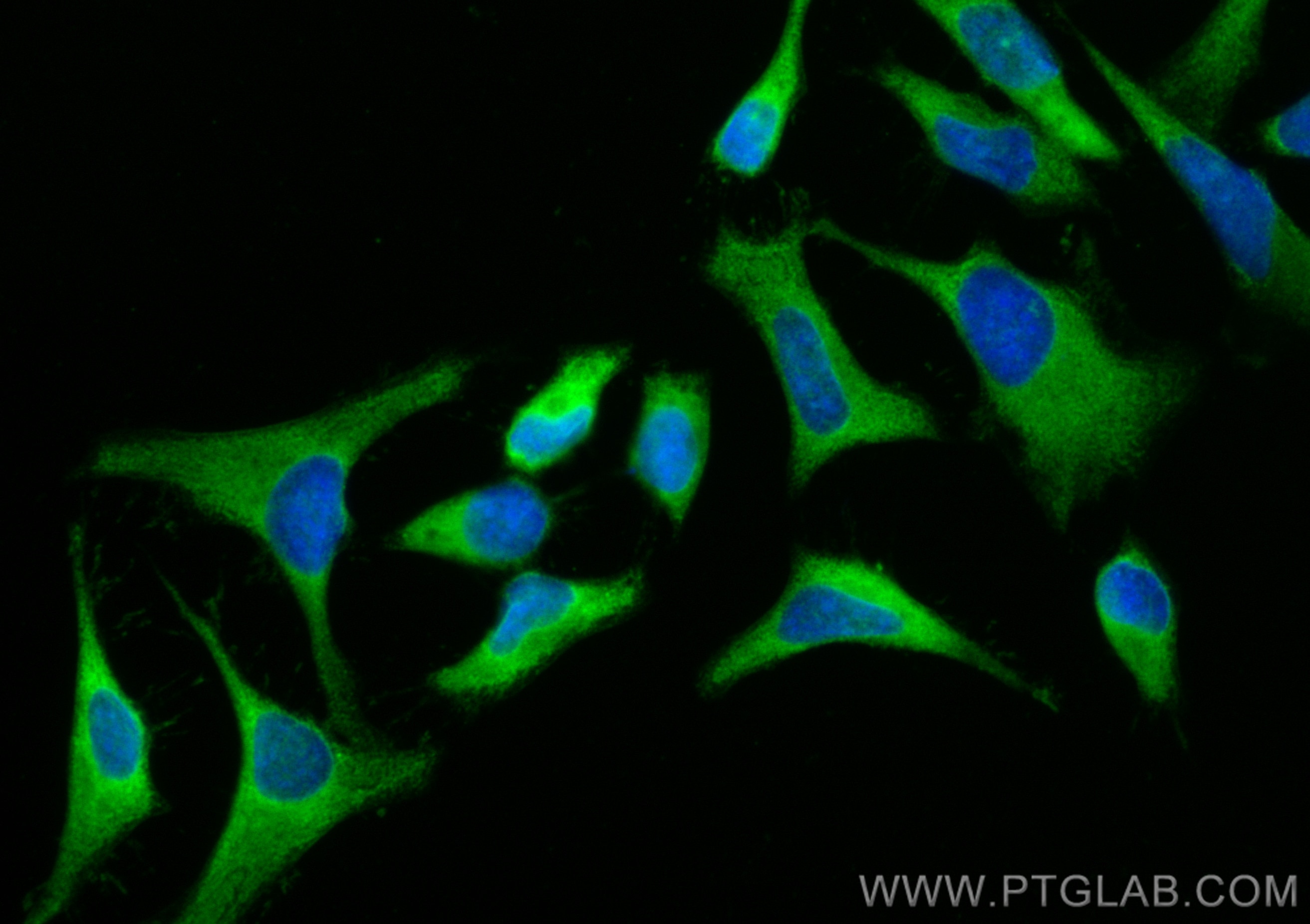 Immunofluorescence (IF) / fluorescent staining of HeLa cells using CoraLite® Plus 488-conjugated PDE4D Polyclonal ant (CL488-12918)