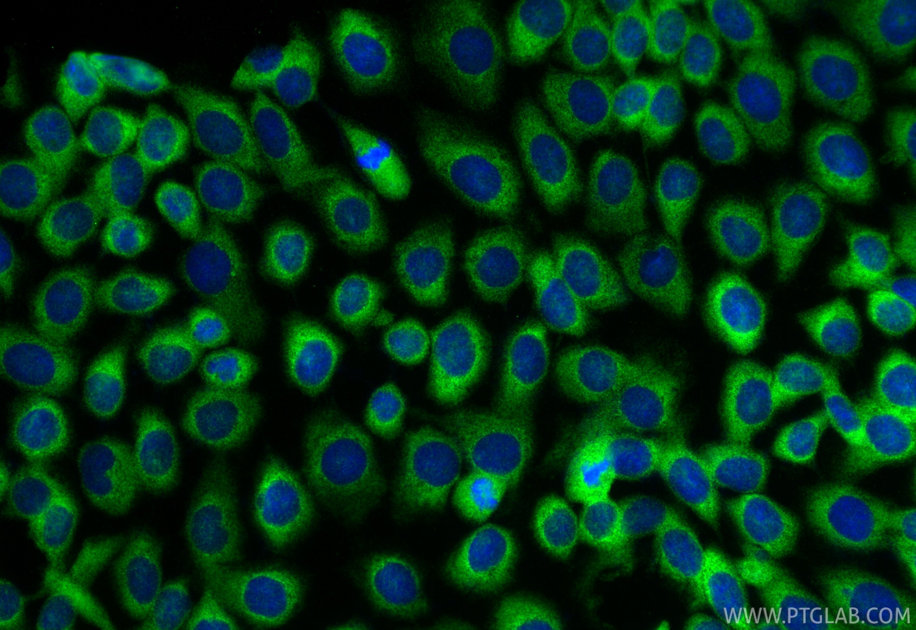 IF Staining of A431 using RMX00108 Immunofluorescence (IF) / fluorescent staining of A431 cells using Multi-rAb® PDE4D Multi-Recombinant antibody (RMX00108)