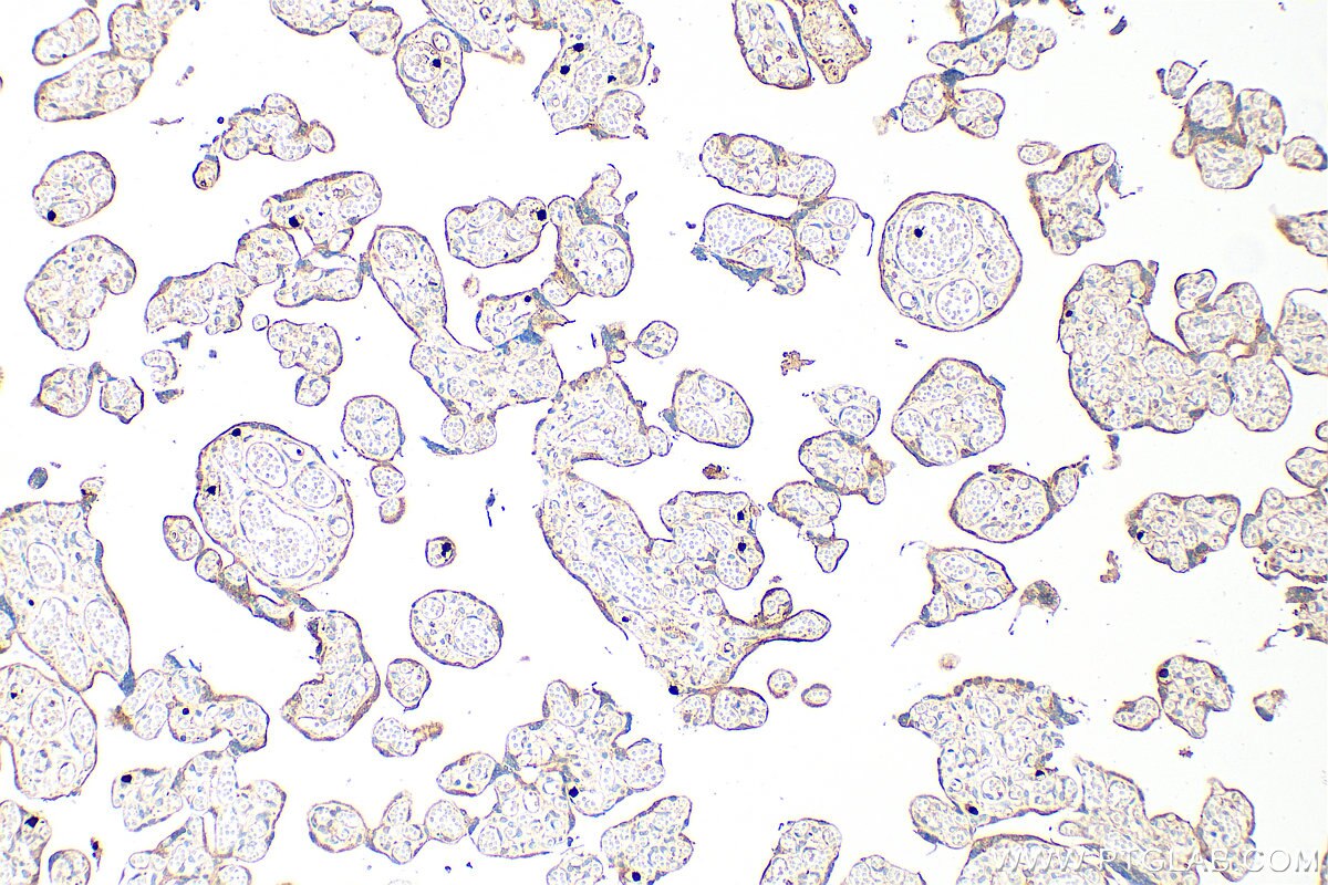 IHC staining of human placenta using RMX00108 Immunohistochemistry (IHC) staining of human placenta tissue using Multi-rAb® PDE4D Multi-Recombinant antibody (RMX00108)