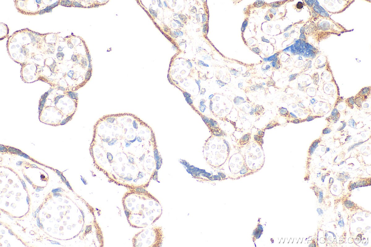 IHC staining of human placenta using RMX00108 Immunohistochemistry (IHC) staining of human placenta tissue using Multi-rAb® PDE4D Multi-Recombinant antibody (RMX00108)