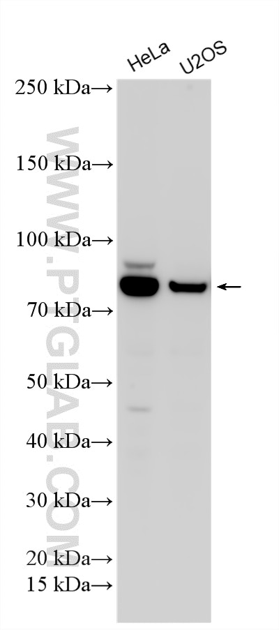 WB analysis using RMX00108 Western Blot (WB) analysis of various lysates using Multi-rAb® PDE4D Multi-Recombinant antibody (RMX00108)