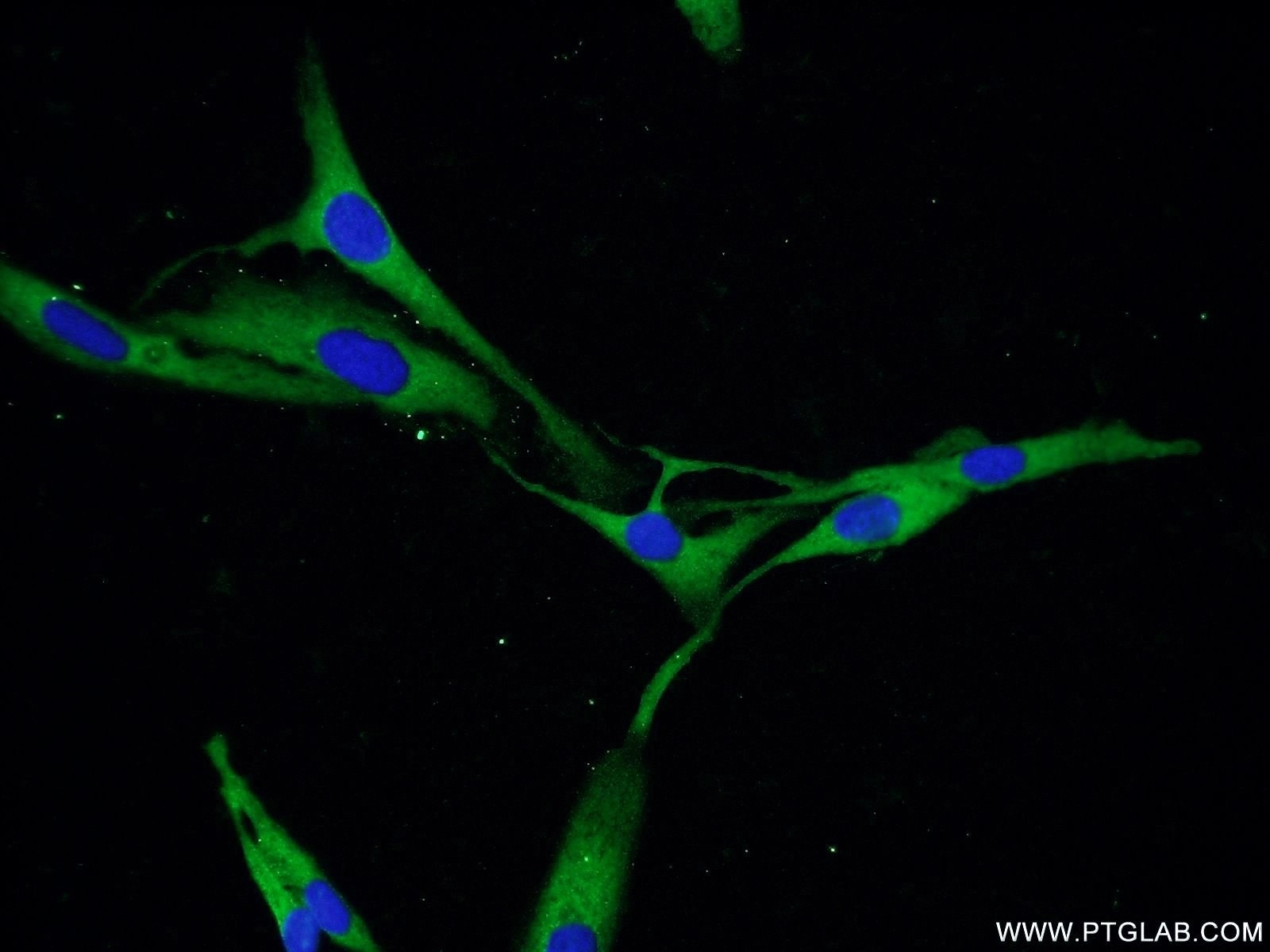 Immunofluorescence (IF) / fluorescent staining of SKOV-3 cells using PDE5A Polyclonal antibody (22624-1-AP)
