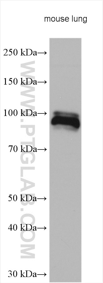 Western Blot (WB) analysis of various lysates using PDE5A Polyclonal antibody (22624-1-AP)