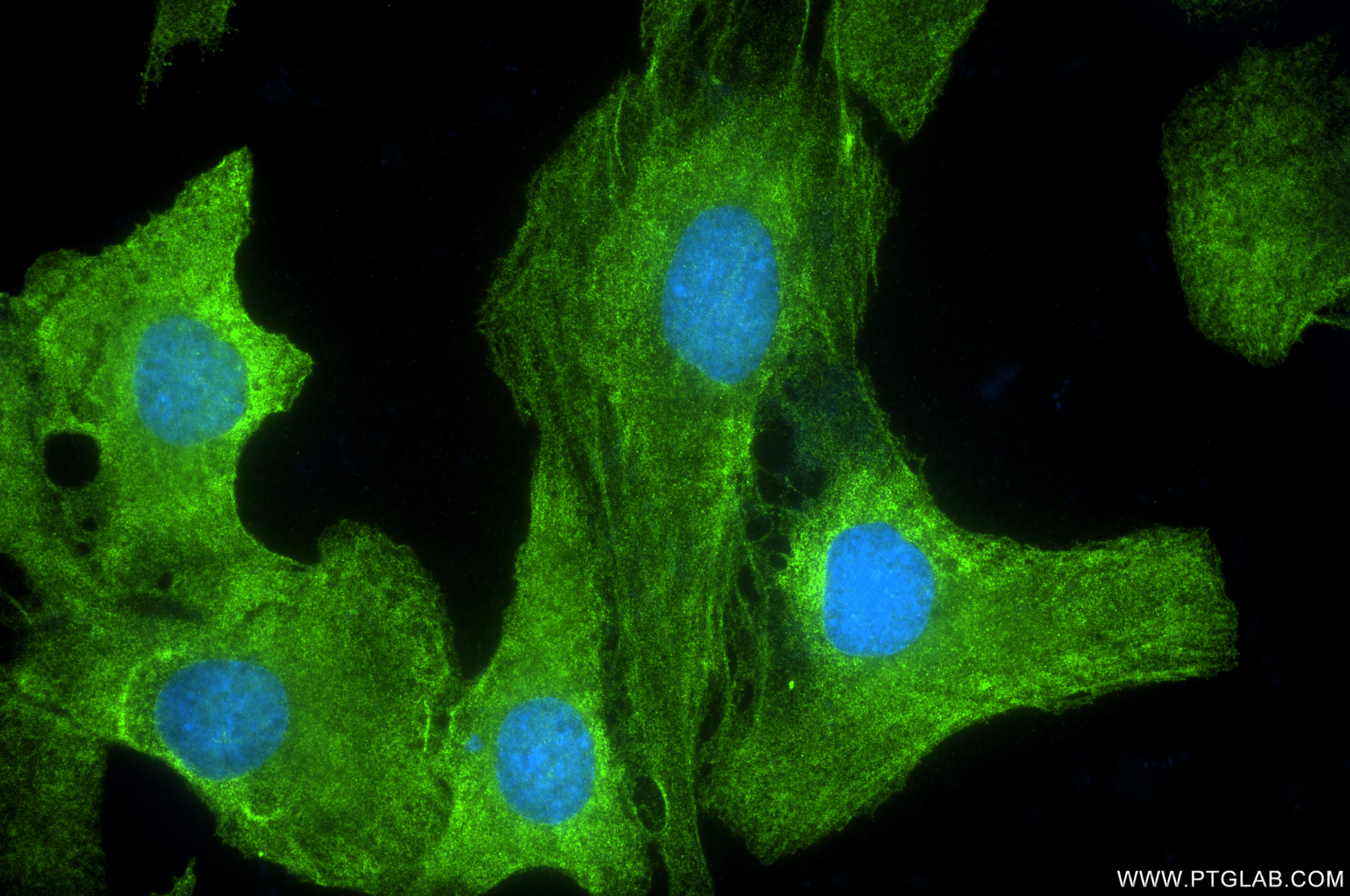 Immunofluorescence (IF) / fluorescent staining of SKOV-3 cells using PDE5A Recombinant antibody (85030-1-RR)
