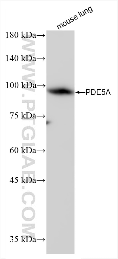 Western Blot (WB) analysis of mouse lung tissue using PDE5A Recombinant antibody (85030-1-RR)
