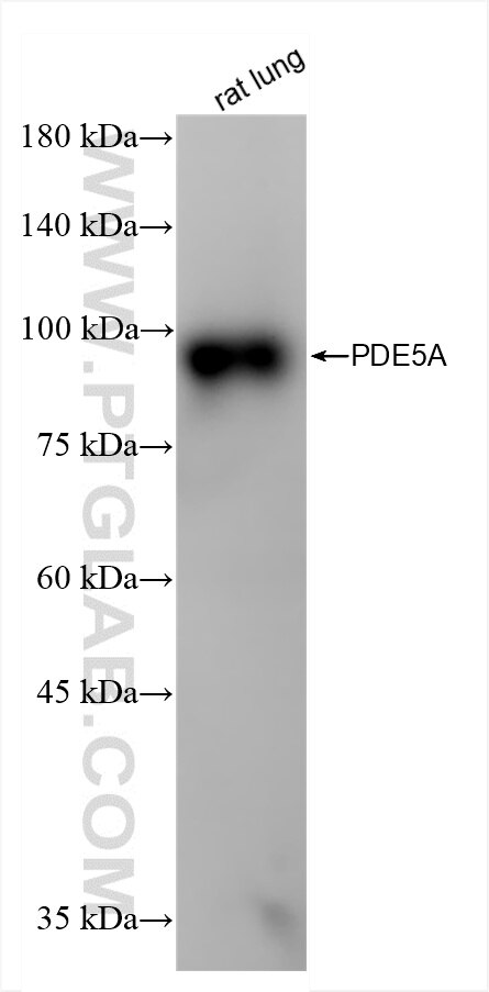 Western Blot (WB) analysis of rat lung tissue using PDE5A Recombinant antibody (85030-1-RR)