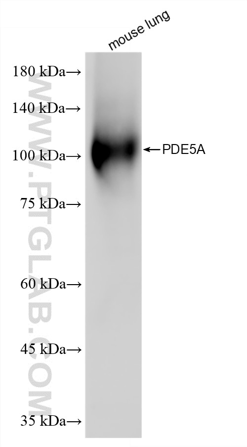 Western Blot (WB) analysis of mouse lung tissue using PDE5A Recombinant monoclonal antibody (85030-5-RR)