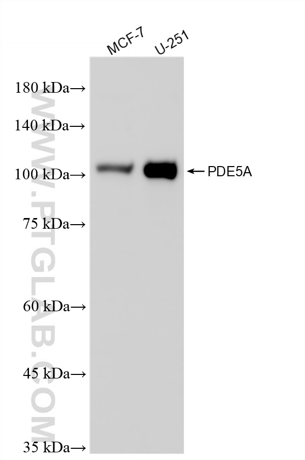 Western Blot (WB) analysis of various lysates using PDE5A Recombinant monoclonal antibody (85030-5-RR)
