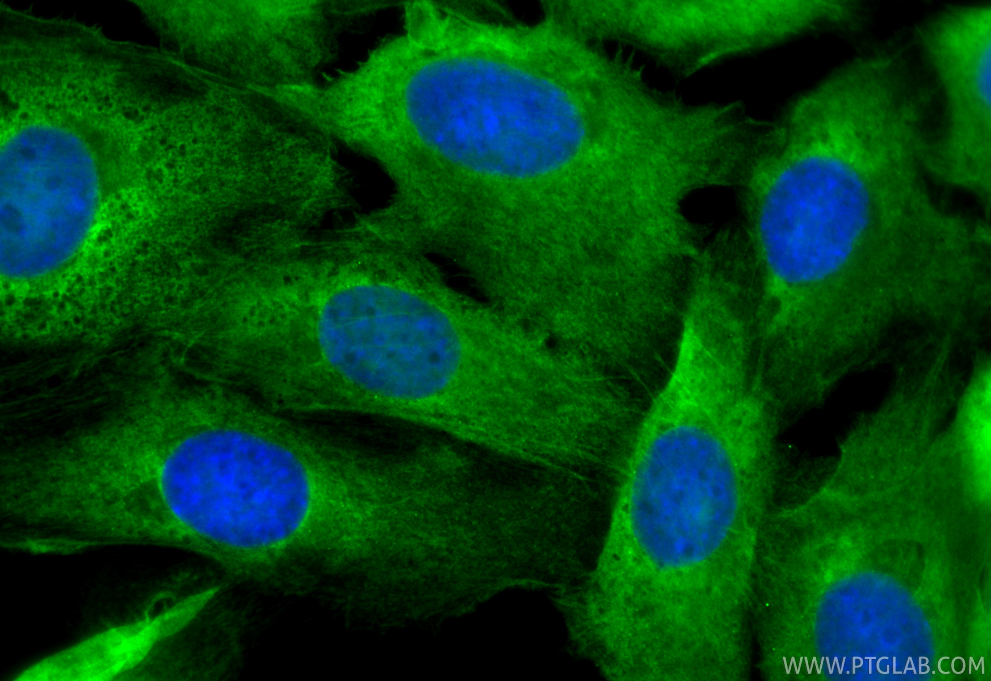 Immunofluorescence (IF) / fluorescent staining of SKOV-3 cells using CoraLite® Plus 488-conjugated PDE5A Recombinant mo (CL488-85030)