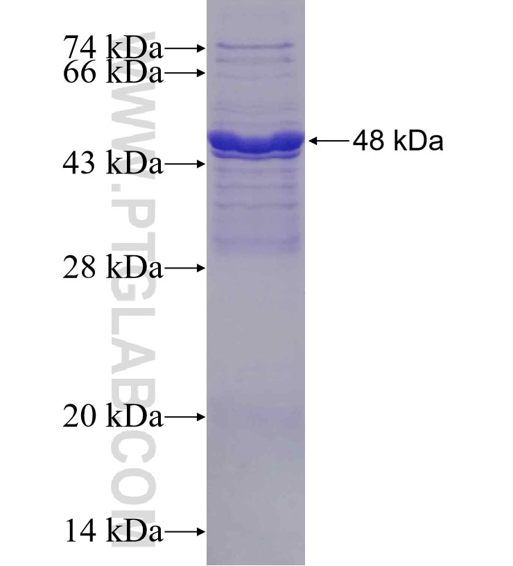 PDE5A fusion protein Ag18779 SDS-PAGE