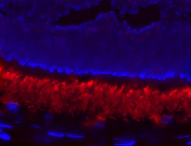 IF Staining of retinal tissue using 21200-1-AP