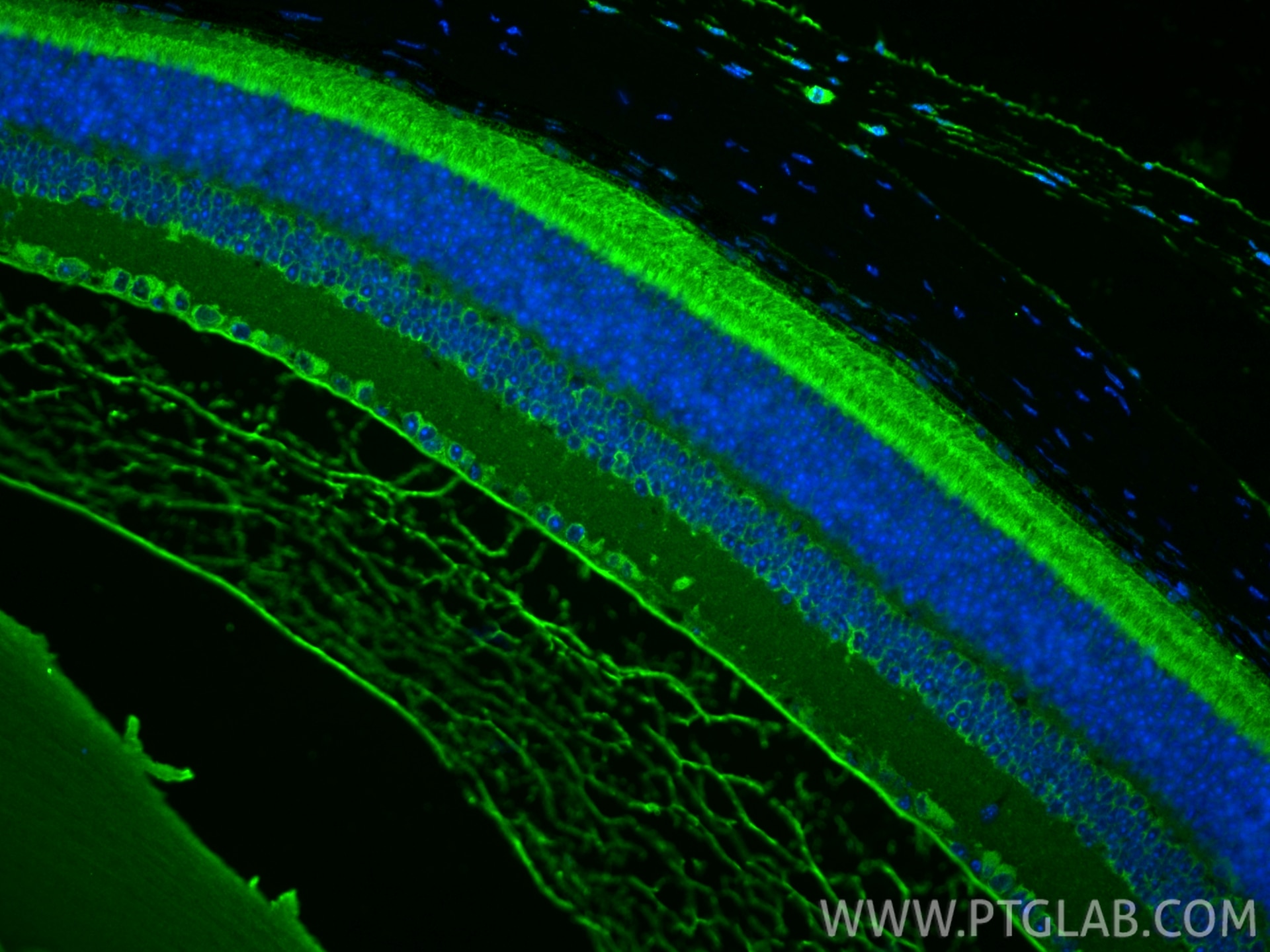 Immunofluorescence (IF) / fluorescent staining of mouse eye tissue using PDE6A Polyclonal antibody (21200-1-AP)