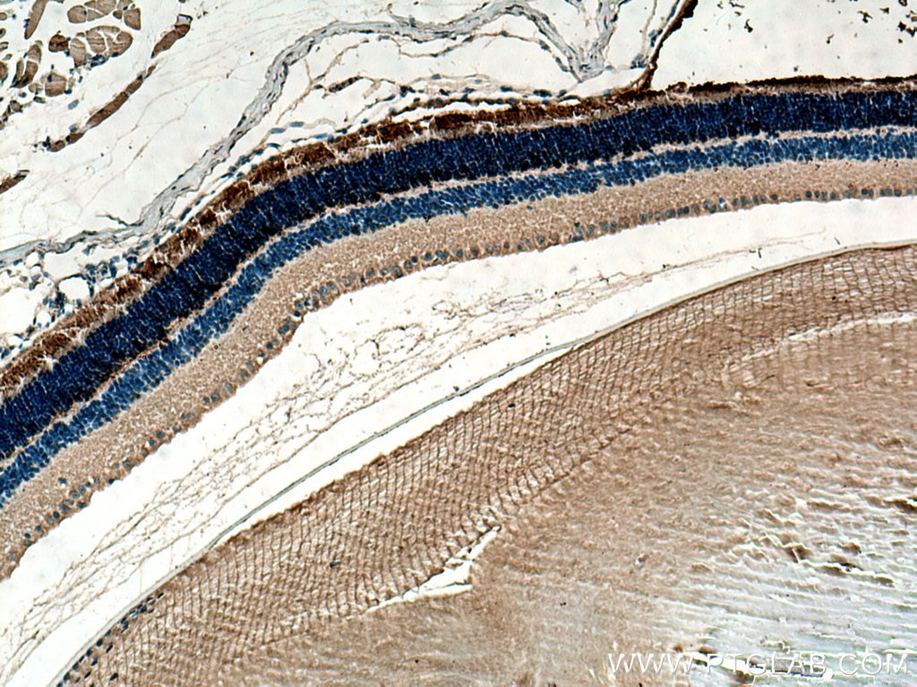 Immunohistochemistry (IHC) staining of mouse eye tissue using PDE6A Polyclonal antibody (21200-1-AP)