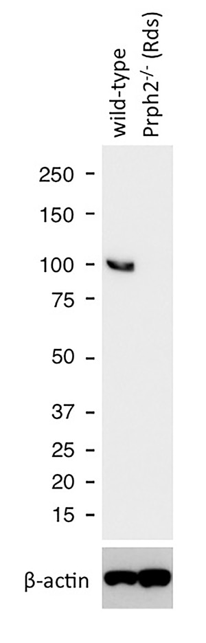 Western Blot (WB) analysis of mouse eye tissue using PDE6A Polyclonal antibody (21200-1-AP)