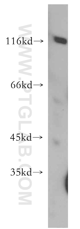 Western Blot (WB) analysis of human brain tissue using PDE6A Polyclonal antibody (21200-1-AP)