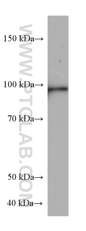 Western Blot (WB) analysis of rat eye tissue using PDE6A Monoclonal antibody (67832-1-Ig)