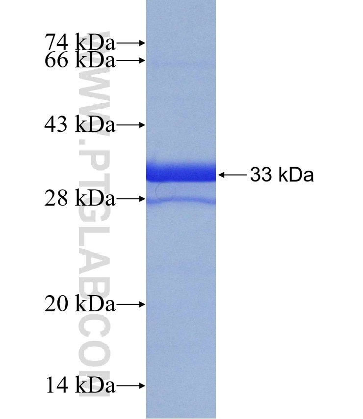 PDE6A fusion protein Ag15562 SDS-PAGE