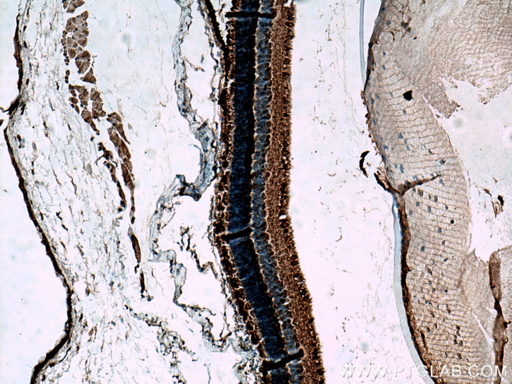 Immunohistochemistry (IHC) staining of mouse eye tissue using PDE6B Polyclonal antibody (10353-1-AP)