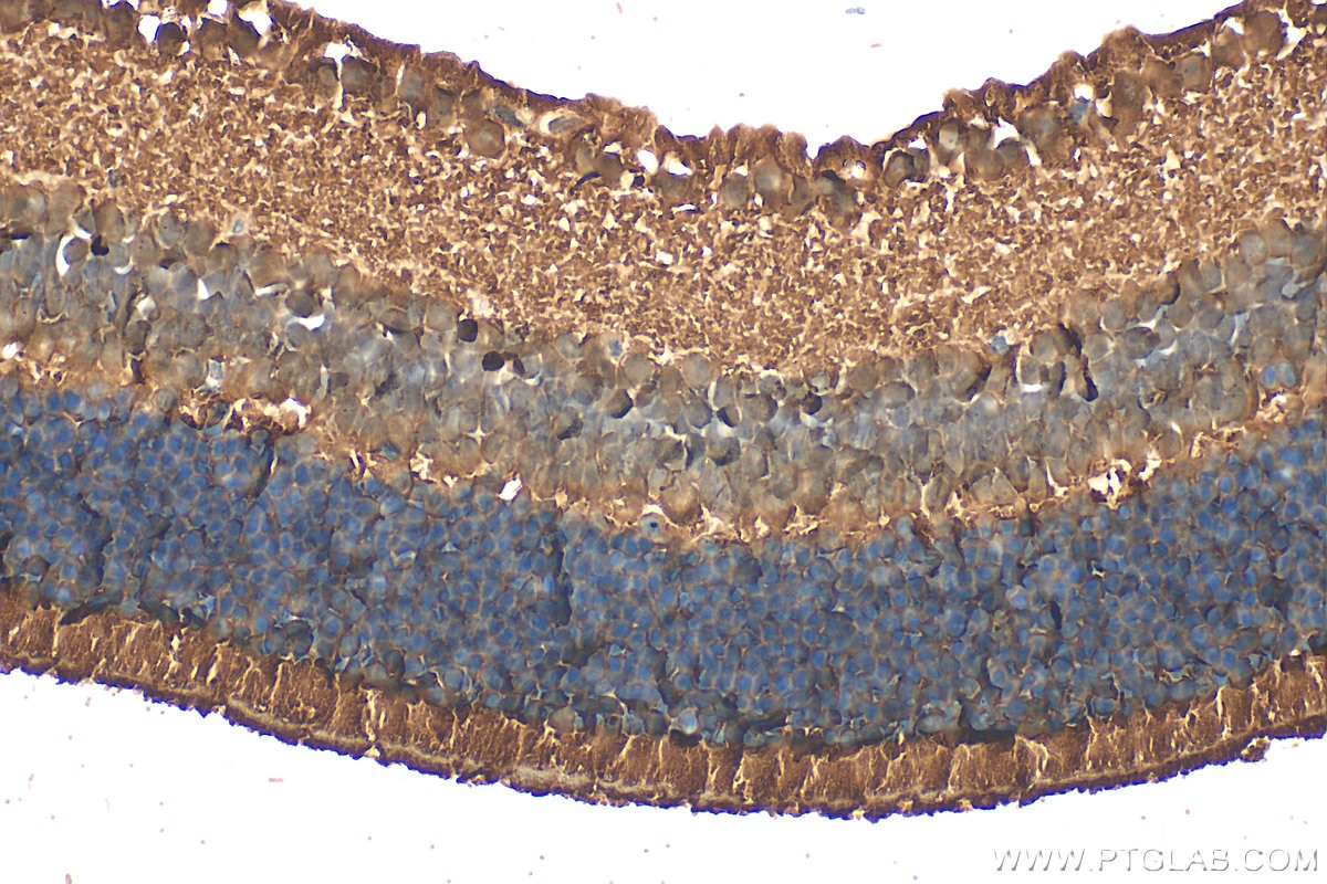 Immunohistochemistry (IHC) staining of mouse eye tissue using PDE6B Polyclonal antibody (10353-1-AP)