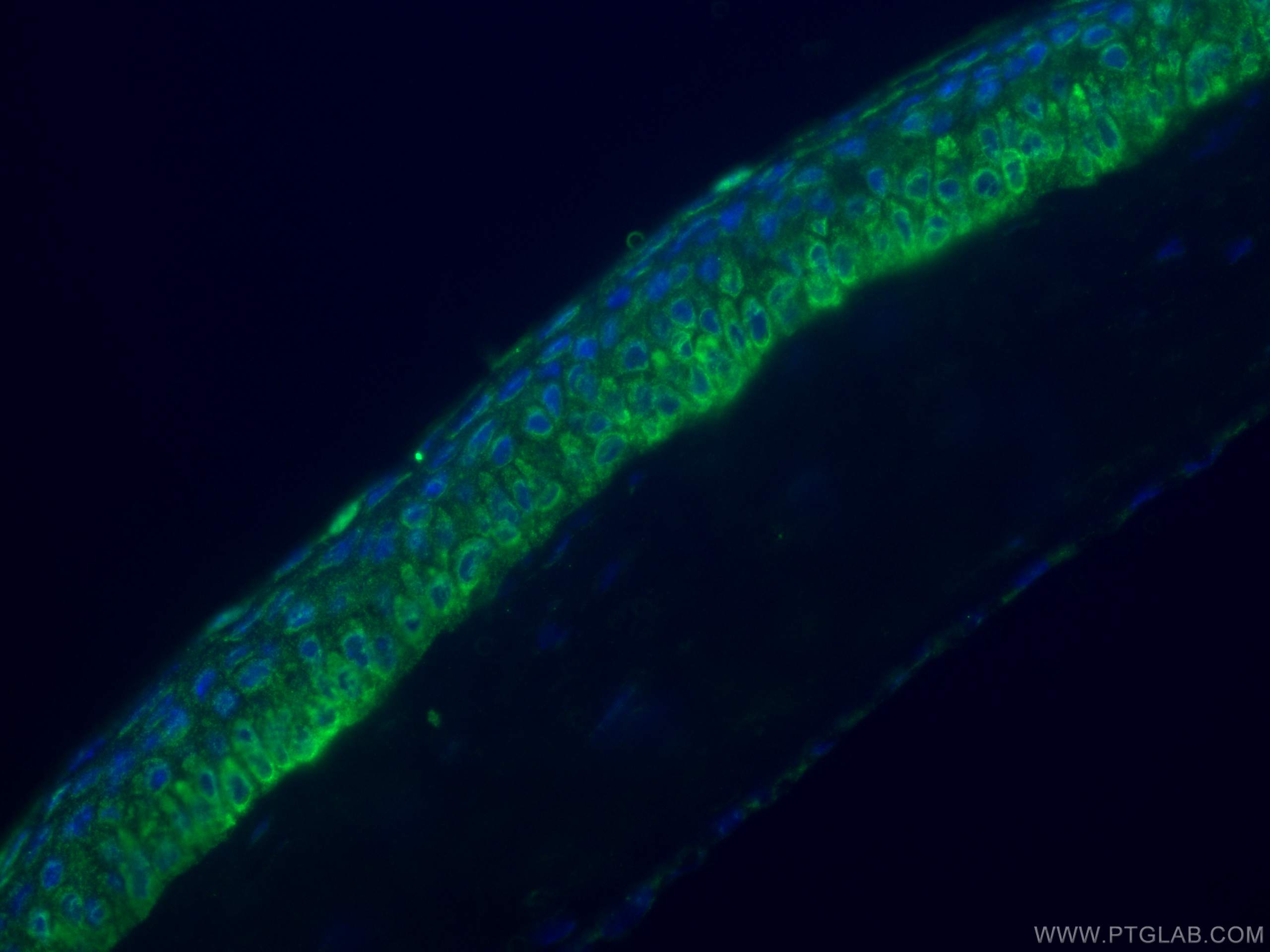 Immunofluorescence (IF) / fluorescent staining of mouse eye tissue using PDE6B Polyclonal antibody (22063-1-AP)