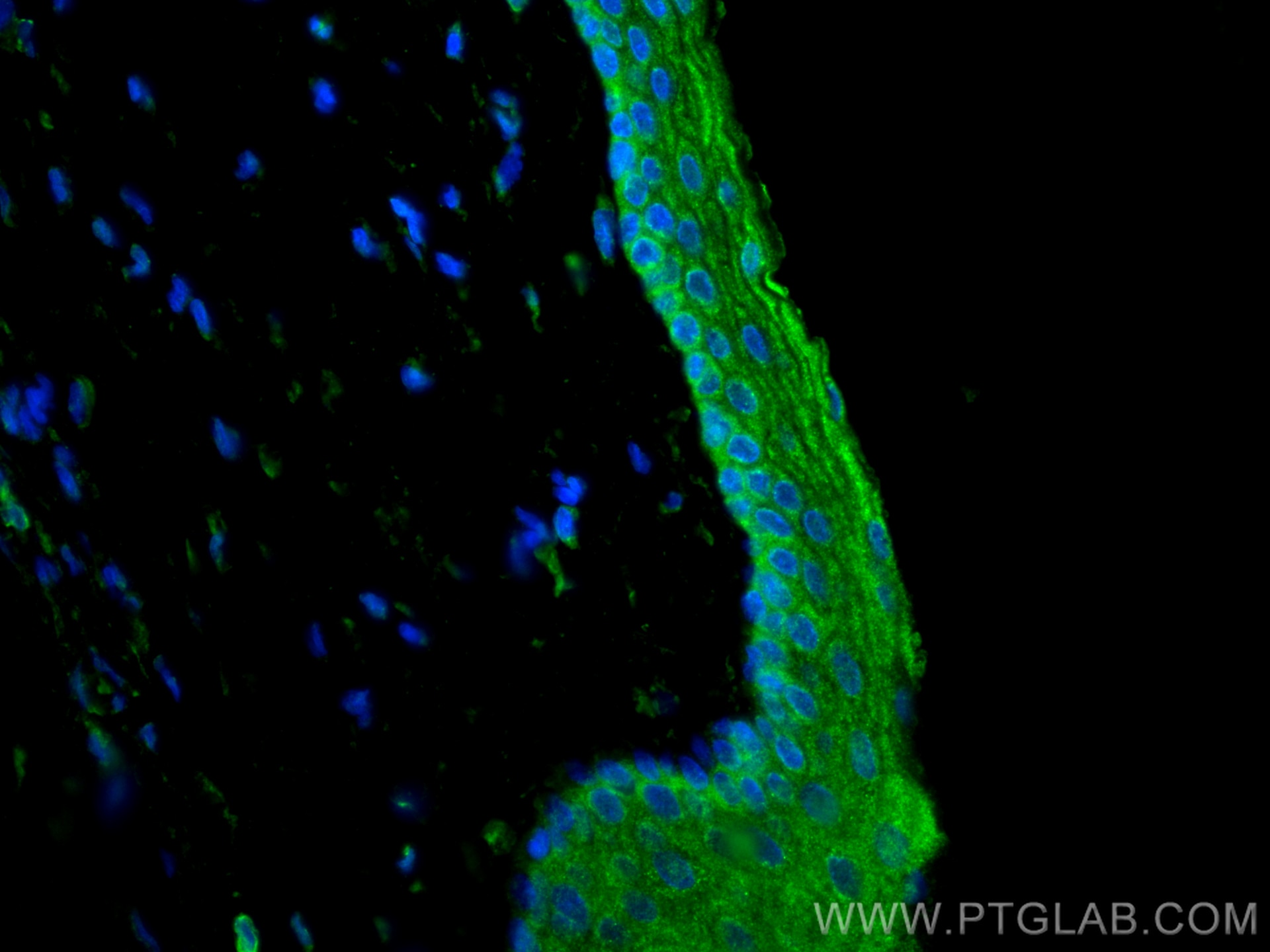 Immunofluorescence (IF) / fluorescent staining of rat eye tissue using PDE6B Polyclonal antibody (22063-1-AP)