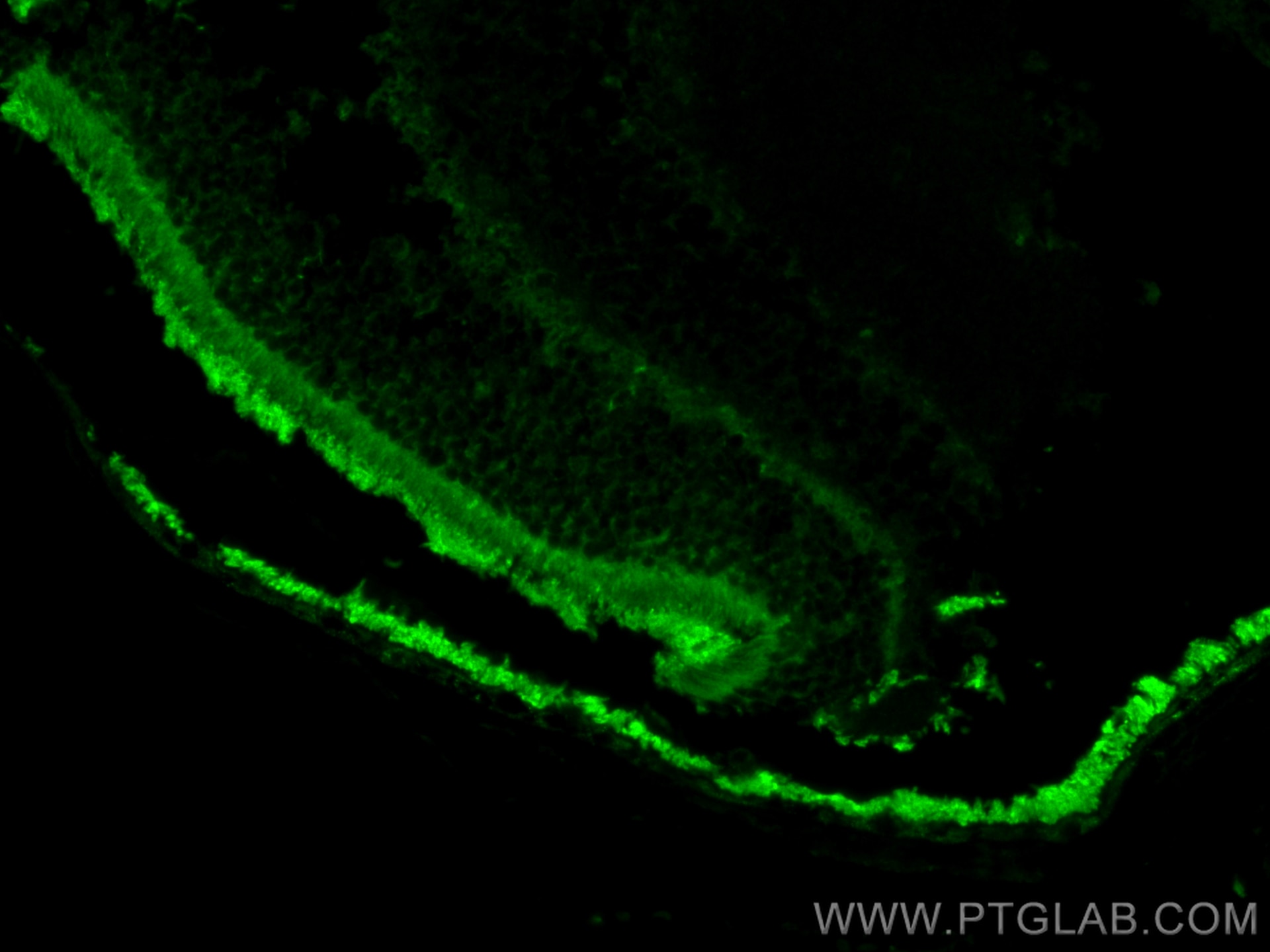 Immunofluorescence (IF) / fluorescent staining of mouse eye tissue using PDE6B Polyclonal antibody (22063-1-AP)