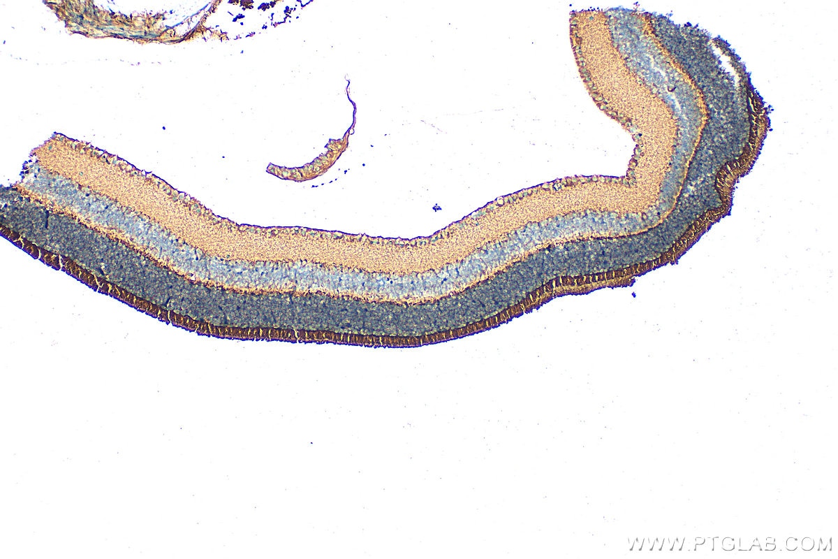 Immunohistochemistry (IHC) staining of mouse eye tissue using PDE6B Polyclonal antibody (22063-1-AP)