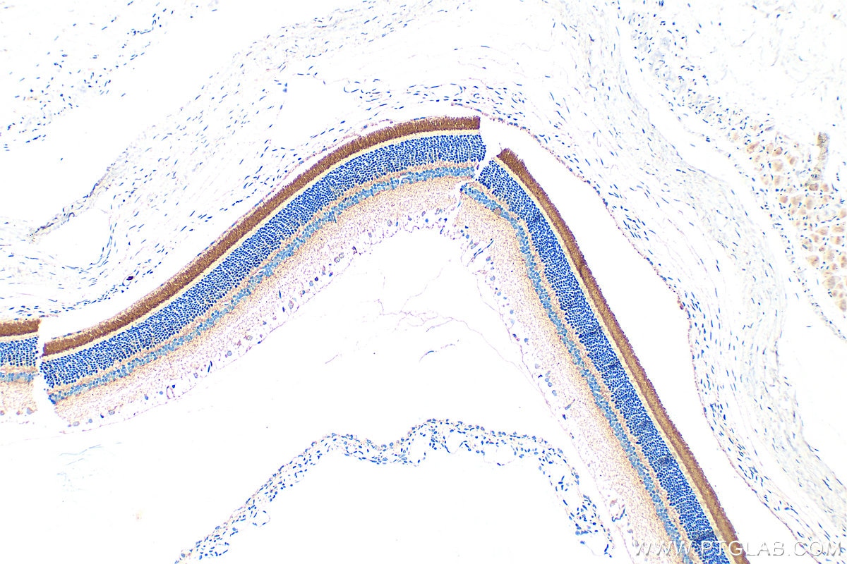 Immunohistochemistry (IHC) staining of rat eye tissue using PDE6B Polyclonal antibody (22063-1-AP)