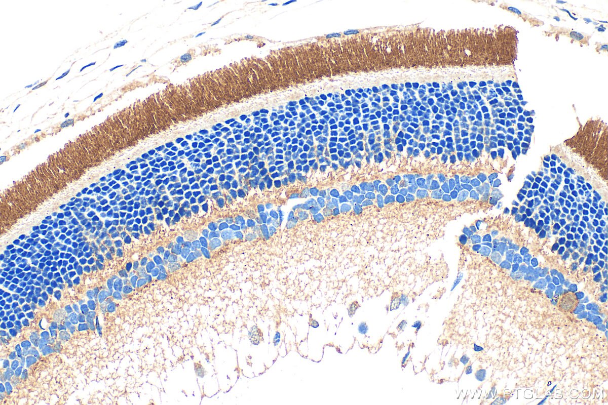 Immunohistochemistry (IHC) staining of rat eye tissue using PDE6B Polyclonal antibody (22063-1-AP)
