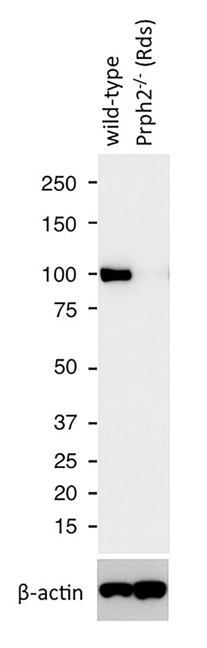 Western Blot (WB) analysis of mouse eye tissue using PDE6B Polyclonal antibody (22063-1-AP)