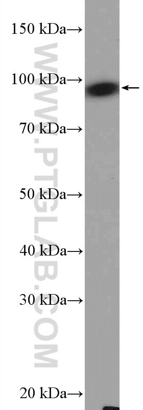 Western Blot (WB) analysis of rat eye tissue using PDE6B Polyclonal antibody (22063-1-AP)