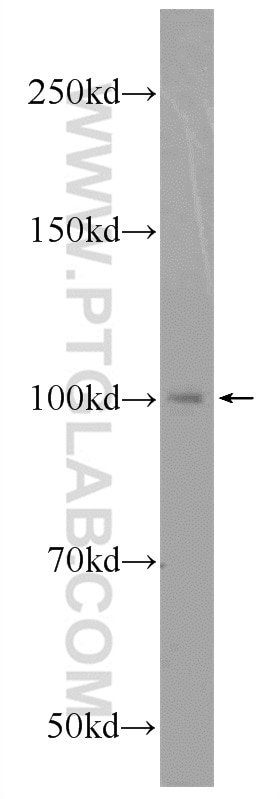 Western Blot (WB) analysis of A549 cells using PDE6B Polyclonal antibody (22063-1-AP)