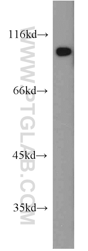 Western Blot (WB) analysis of mouse eye tissue using PDE6B Polyclonal antibody (22063-1-AP)