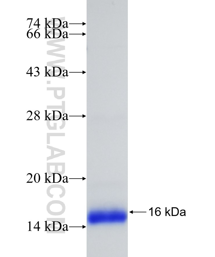 PDE6B fusion protein Ag17469 SDS-PAGE