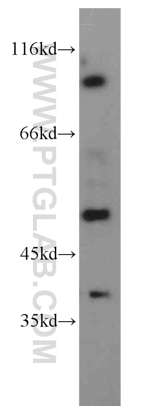Western Blot (WB) analysis of Y79 cells using PDE6C Polyclonal antibody (55183-1-AP)
