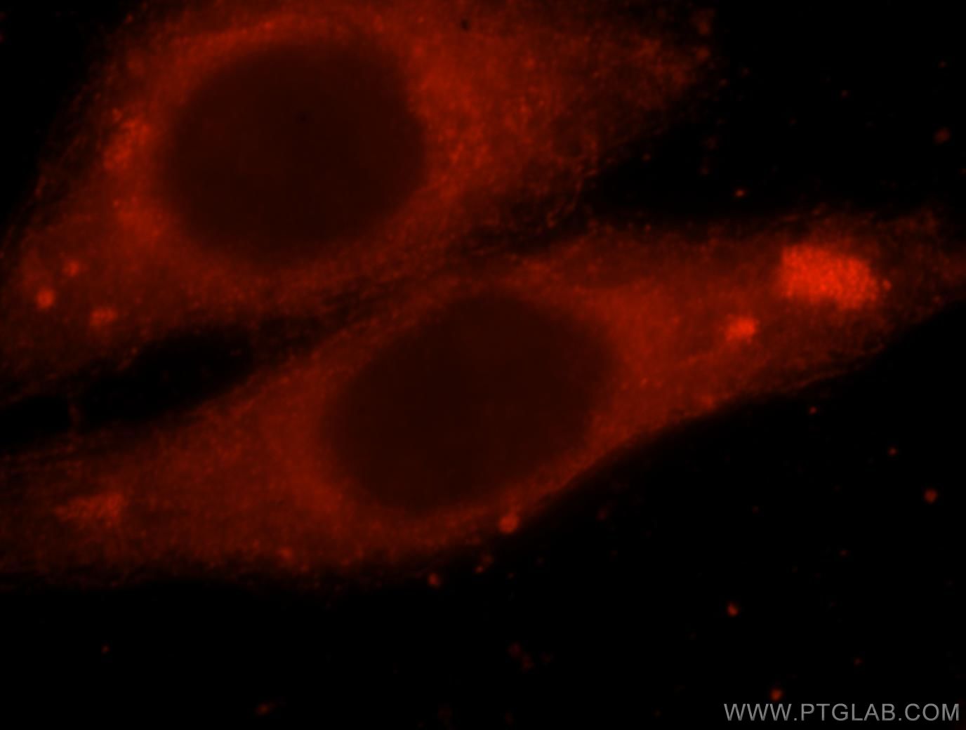 Immunofluorescence (IF) / fluorescent staining of HepG2 cells using PDE7B Polyclonal antibody (17771-1-AP)
