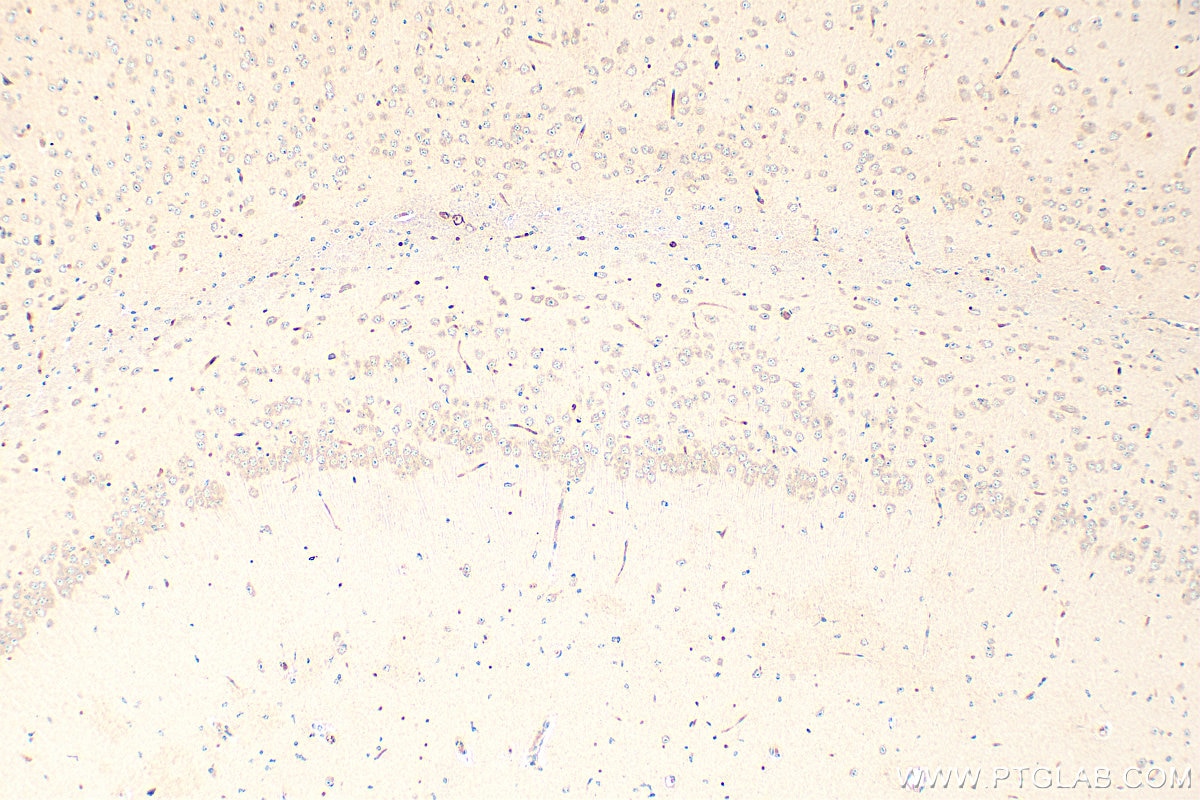 Immunohistochemistry (IHC) staining of mouse brain tissue using PDE7B Polyclonal antibody (17771-1-AP)