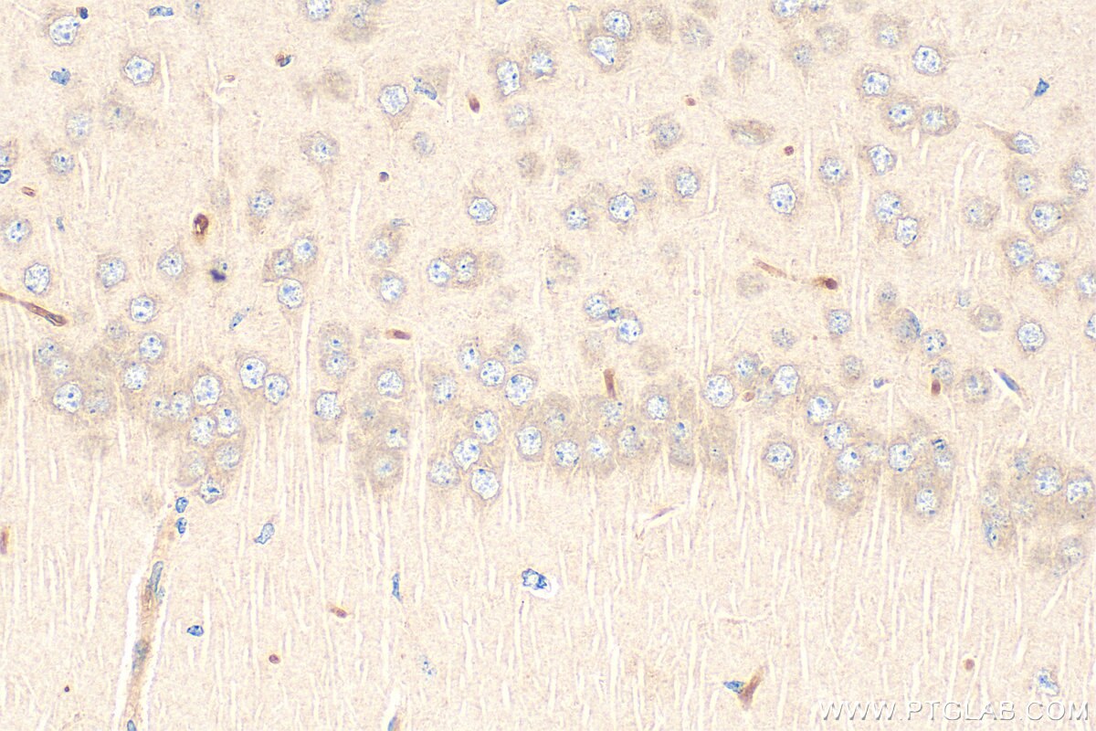Immunohistochemistry (IHC) staining of mouse brain tissue using PDE7B Polyclonal antibody (17771-1-AP)