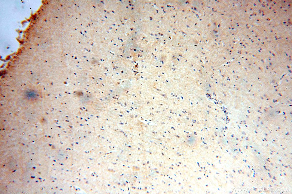 IHC staining of human brain using 17771-1-AP