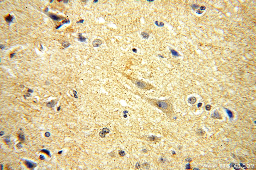 Immunohistochemistry (IHC) staining of human brain tissue using PDE7B Polyclonal antibody (17771-1-AP)