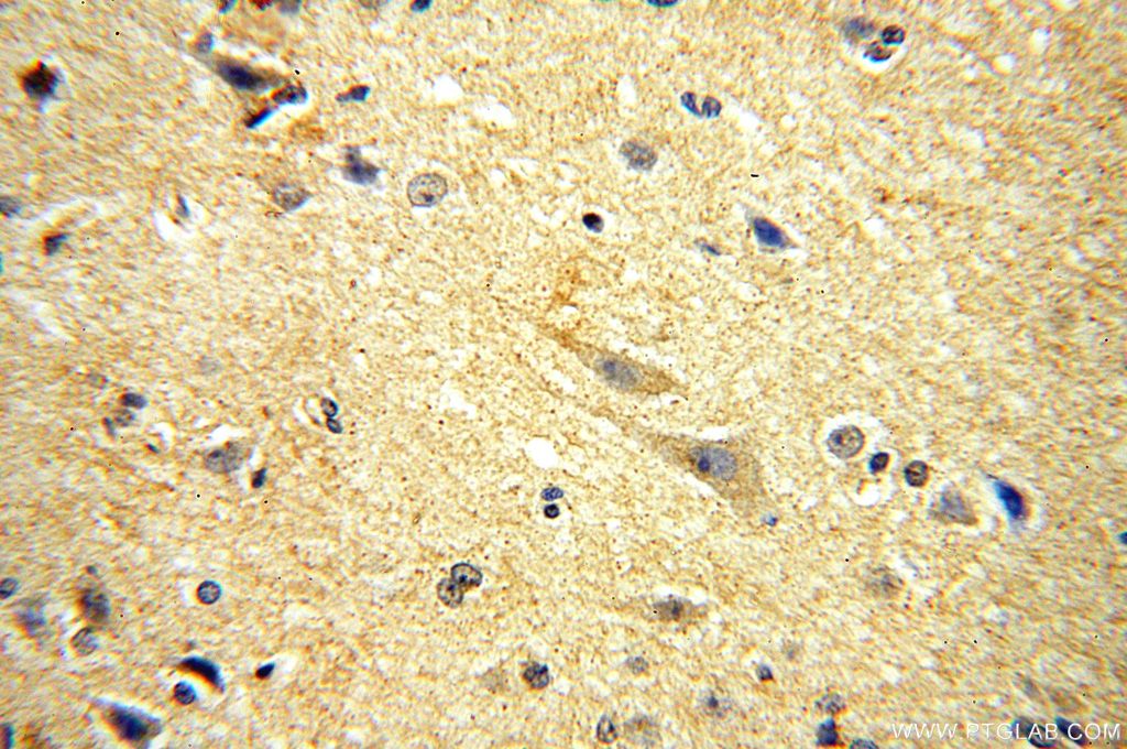 IHC staining of human brain using 17771-1-AP