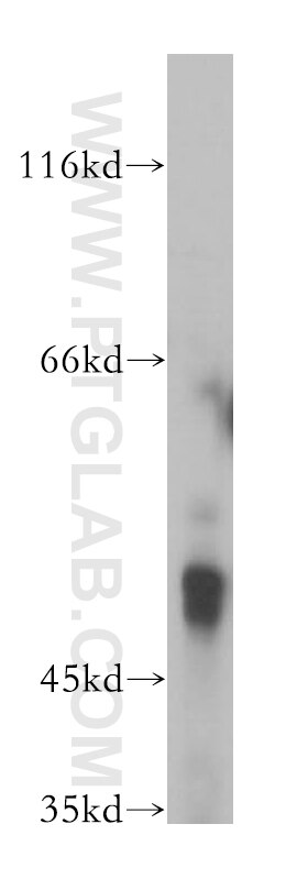 Western Blot (WB) analysis of mouse brain tissue using PDE7B Polyclonal antibody (17771-1-AP)