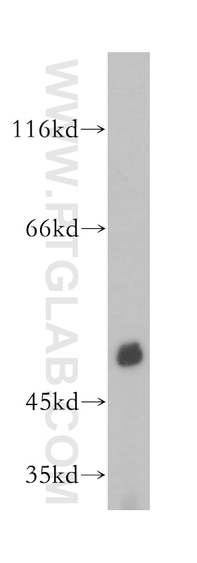 Western Blot (WB) analysis of HeLa cells using PDE7B Polyclonal antibody (17771-1-AP)